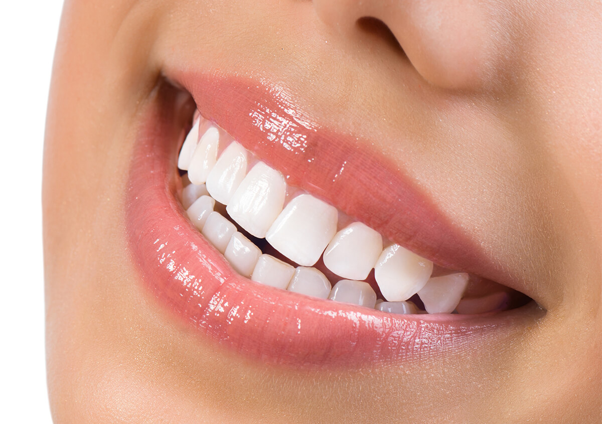 The Power of Dental Veneers: Achieve a Flawless Smile